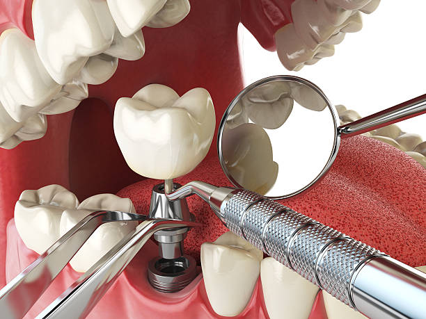 Best Emergency Treatment for Oral Infections in USA